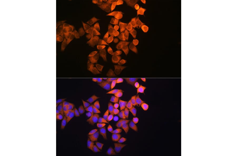 Immunofluorescence - Anti-RRM1 Antibody (A13328) - Antibodies.com