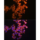 Immunofluorescence - Anti-RRM1 Antibody (A13328) - Antibodies.com