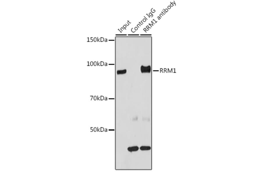 Western Blot - Anti-RRM1 Antibody (A13328) - Antibodies.com