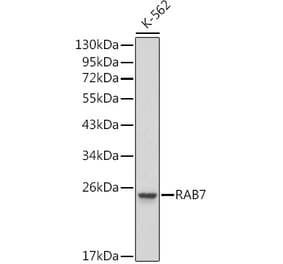 Western Blot - Anti-RAB7 Antibody (A13330) - Antibodies.com
