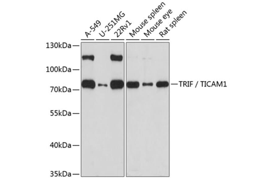 Western Blot - Anti-TRIF Antibody (A13331) - Antibodies.com