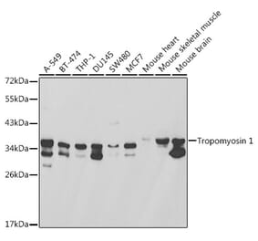 Western Blot - Anti-Tropomyosin 1 (alpha) Antibody (A13333) - Antibodies.com