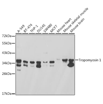 Western Blot - Anti-Tropomyosin 1 (alpha) Antibody (A13333) - Antibodies.com