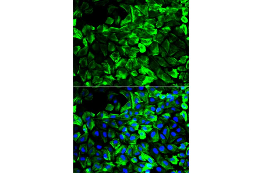 Immunofluorescence - Anti-Tropomyosin 1 (alpha) Antibody (A13333) - Antibodies.com