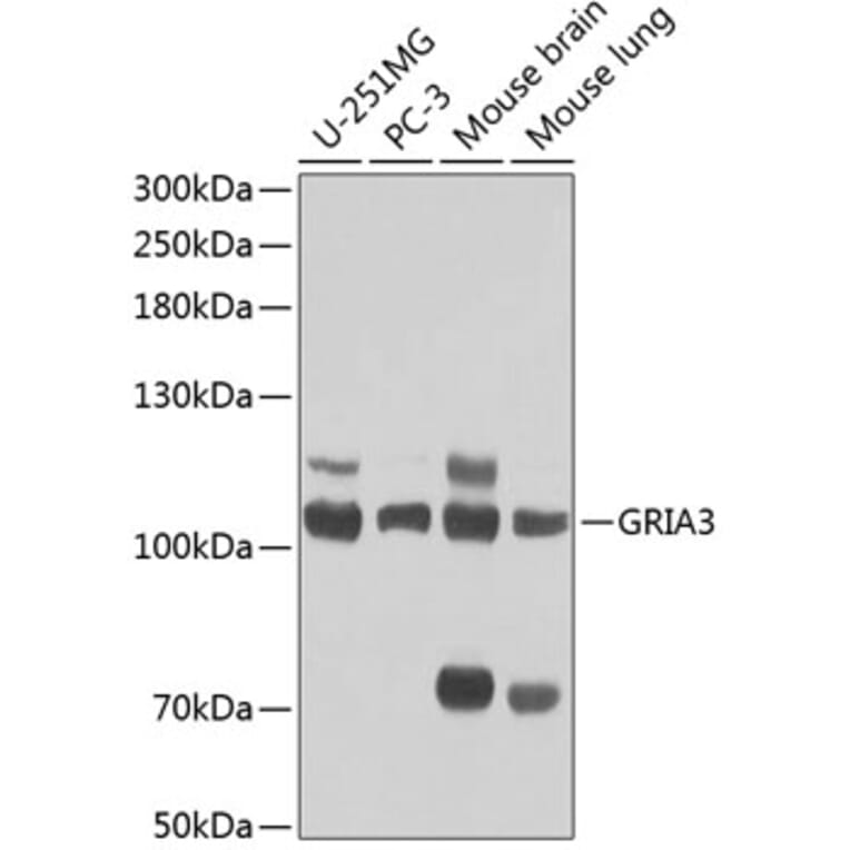 Western Blot - Anti-GRIA3 Antibody (A1159) - Antibodies.com