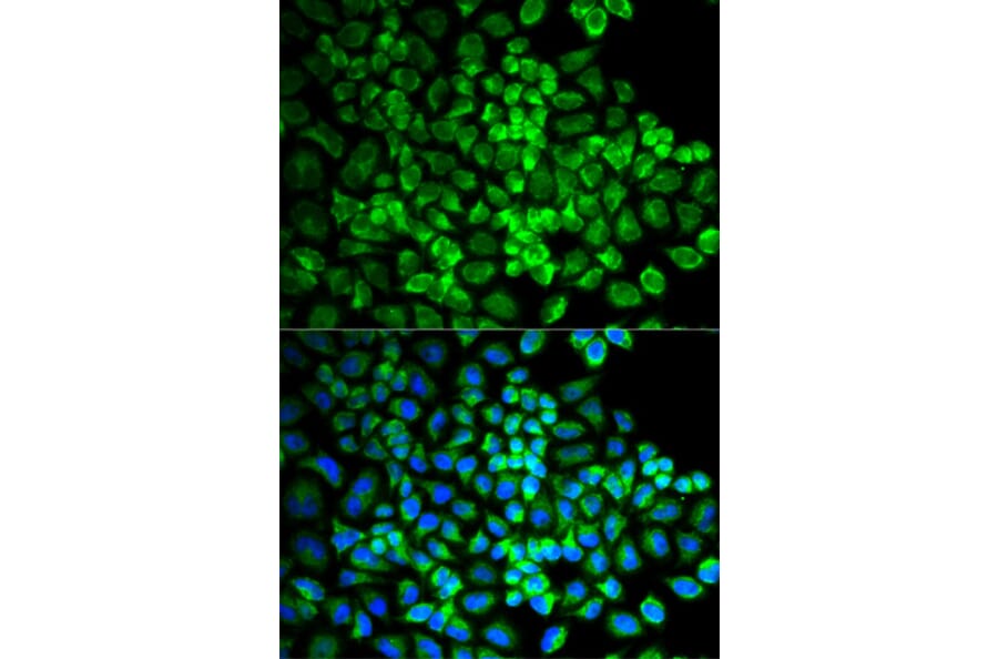 Immunofluorescence - Anti-GRIA3 Antibody (A1159) - Antibodies.com