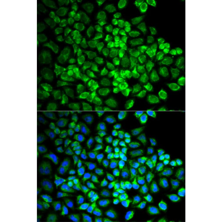 Immunofluorescence - Anti-GRIA3 Antibody (A1159) - Antibodies.com