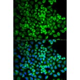 Immunofluorescence - Anti-GRIA3 Antibody (A1159) - Antibodies.com