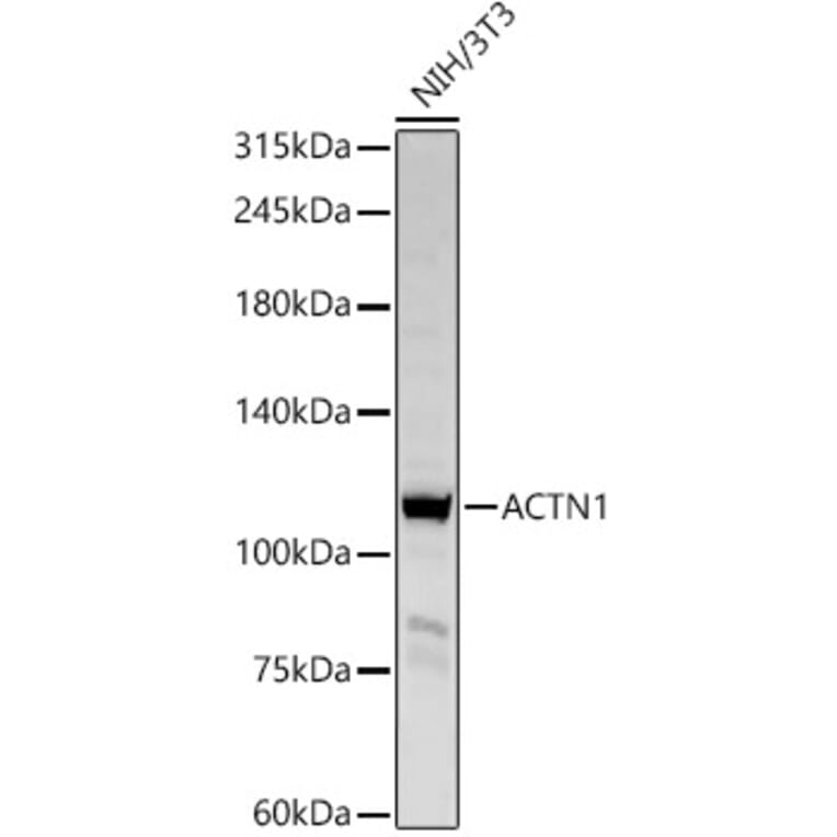 Western Blot - Anti-alpha Actinin/ACTN1 Antibody (A13336) - Antibodies.com