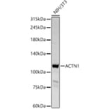 Western Blot - Anti-alpha Actinin/ACTN1 Antibody (A13336) - Antibodies.com