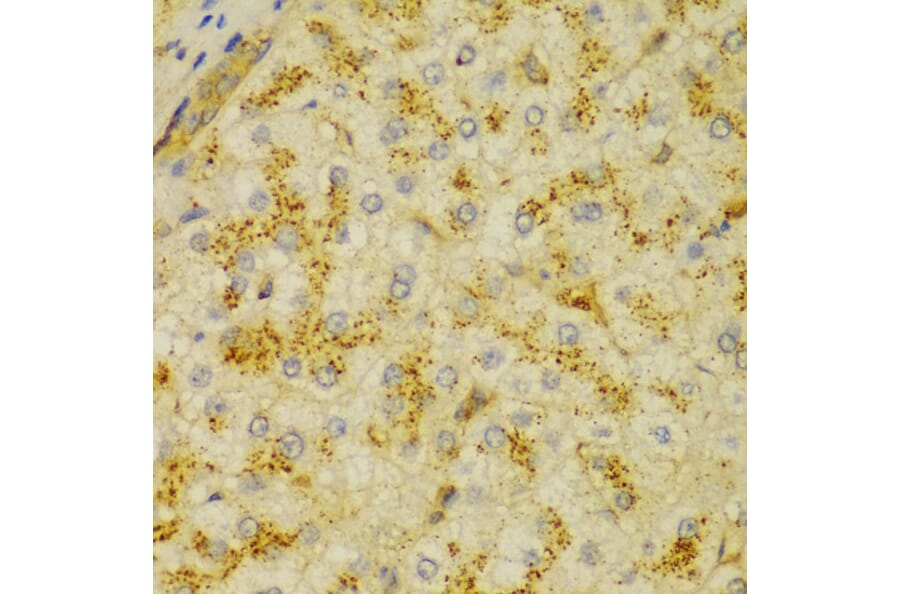Immunohistochemistry - Anti-alpha Actinin/ACTN1 Antibody (A13336) - Antibodies.com