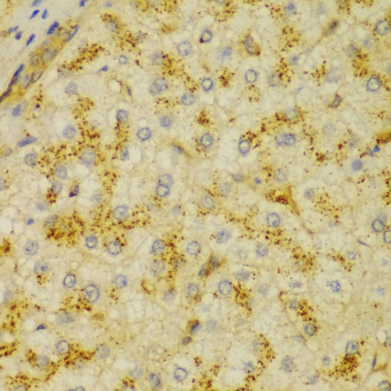 Immunohistochemistry - Anti-alpha Actinin/ACTN1 Antibody (A13336) - Antibodies.com