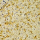 Immunohistochemistry - Anti-alpha Actinin/ACTN1 Antibody (A13336) - Antibodies.com