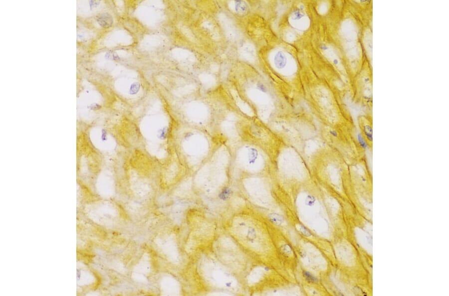 Immunohistochemistry - Anti-alpha Actinin/ACTN1 Antibody (A13336) - Antibodies.com
