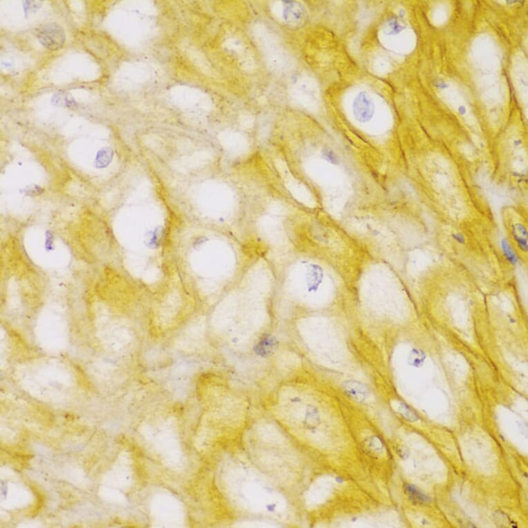 Immunohistochemistry - Anti-alpha Actinin/ACTN1 Antibody (A13336) - Antibodies.com