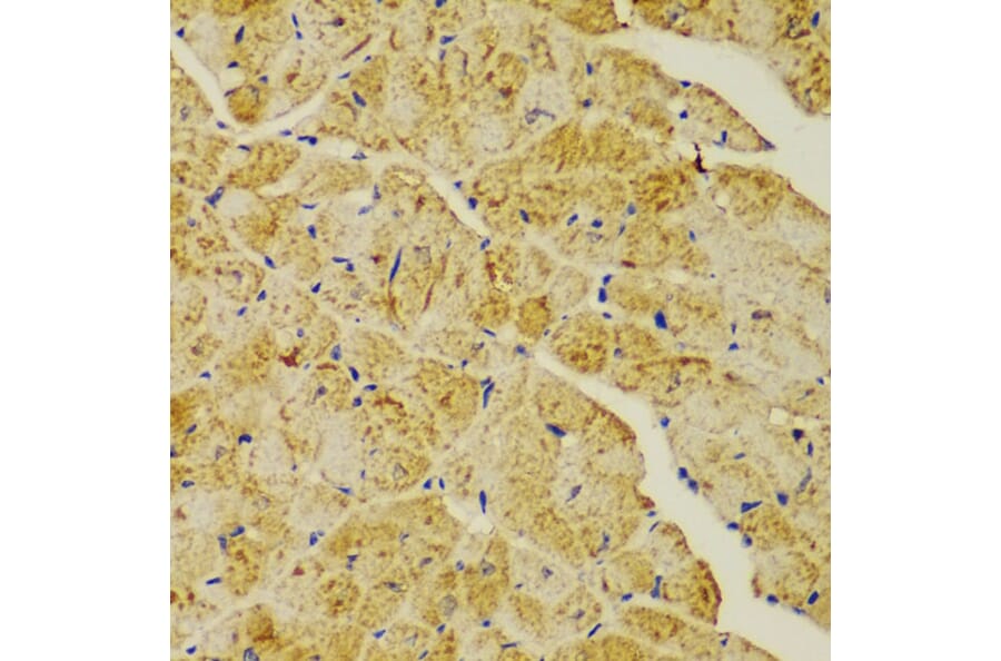 Immunohistochemistry - Anti-alpha Actinin/ACTN1 Antibody (A13336) - Antibodies.com