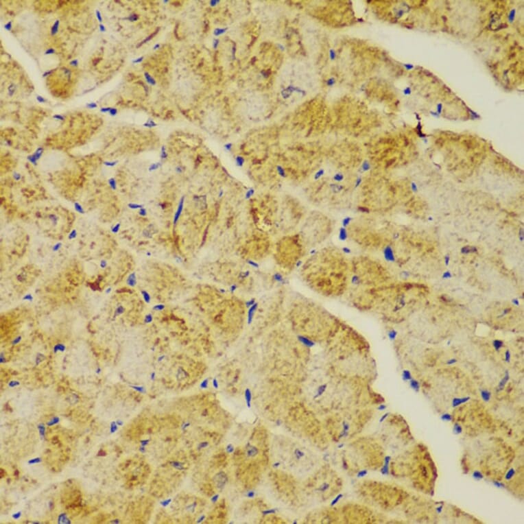 Immunohistochemistry - Anti-alpha Actinin/ACTN1 Antibody (A13336) - Antibodies.com