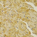 Immunohistochemistry - Anti-alpha Actinin/ACTN1 Antibody (A13336) - Antibodies.com