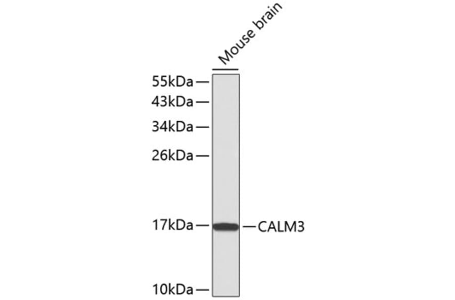 Western Blot - Anti-Calmodulin 1/2/3 Antibody (A13337) - Antibodies.com
