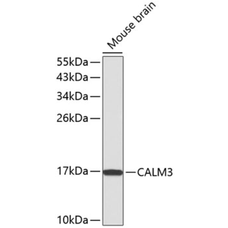 Western Blot - Anti-Calmodulin 1/2/3 Antibody (A13337) - Antibodies.com