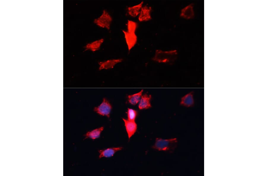 Immunofluorescence - Anti-Calmodulin 1/2/3 Antibody (A13337) - Antibodies.com
