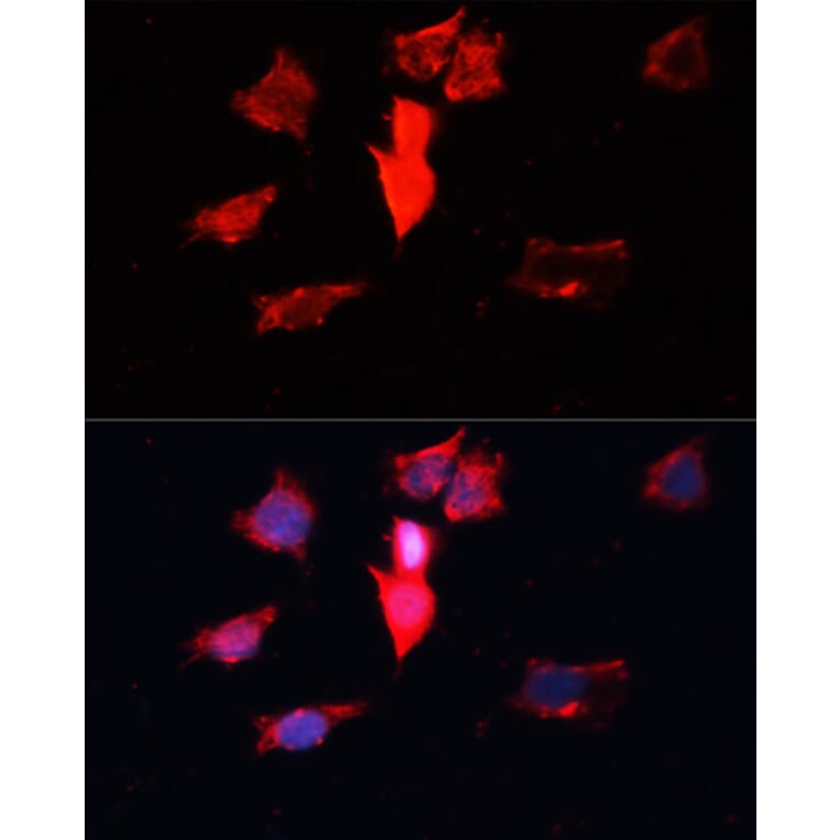 Immunofluorescence - Anti-Calmodulin 1/2/3 Antibody (A13337) - Antibodies.com