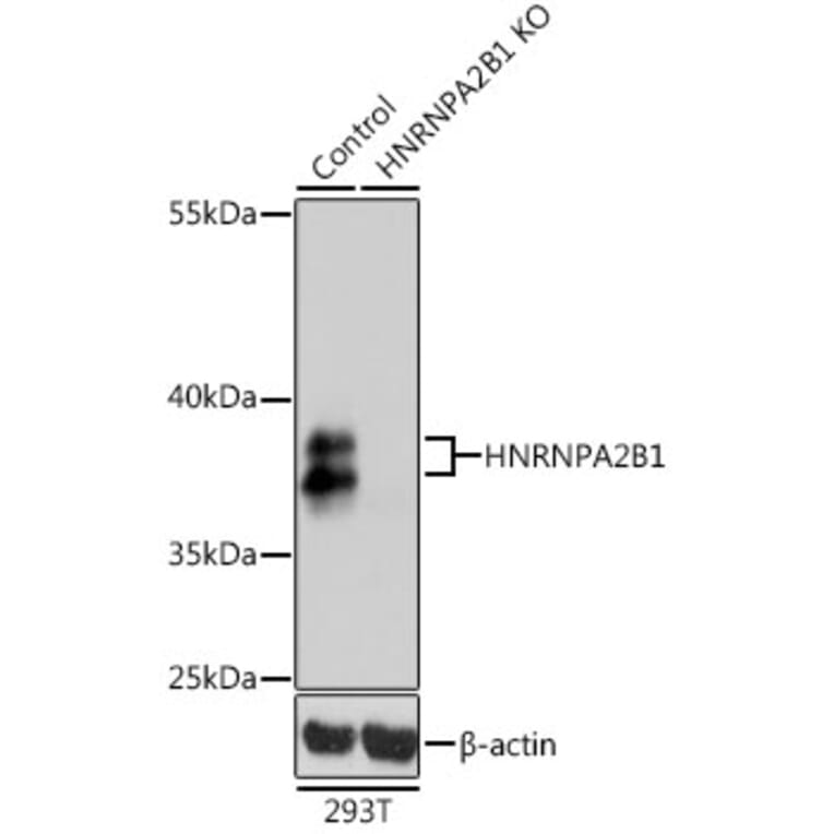 Western Blot - Anti-hnRNP A2B1 Antibody (A13338) - Antibodies.com