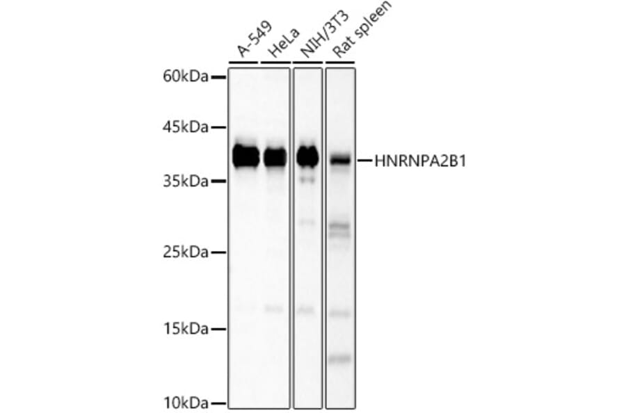 Western Blot - Anti-hnRNP A2B1 Antibody (A13338) - Antibodies.com