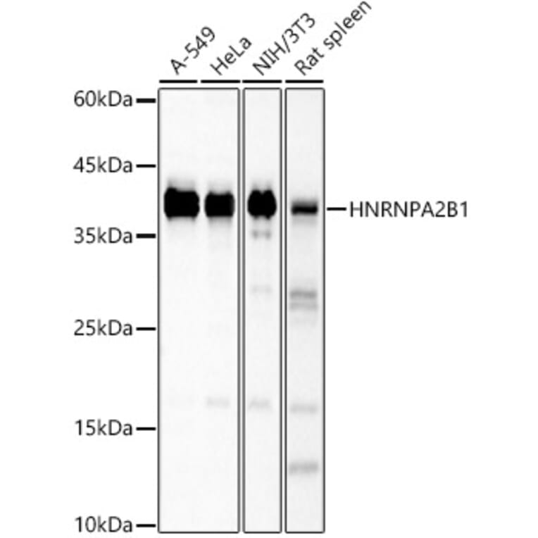 Western Blot - Anti-hnRNP A2B1 Antibody (A13338) - Antibodies.com