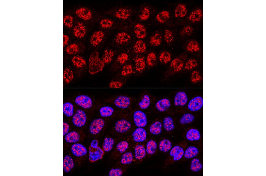 Immunofluorescence - Anti-hnRNP A2B1 Antibody (A13338) - Antibodies.com