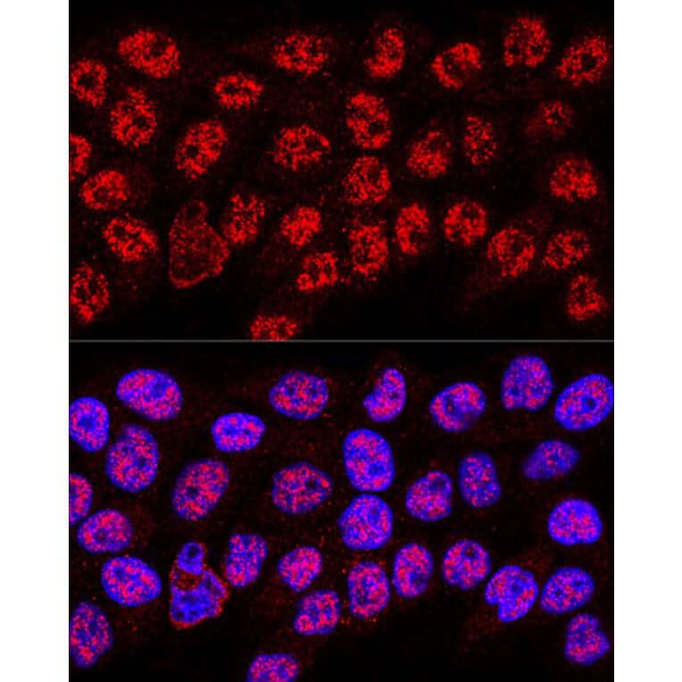 Immunofluorescence - Anti-hnRNP A2B1 Antibody (A13338) - Antibodies.com