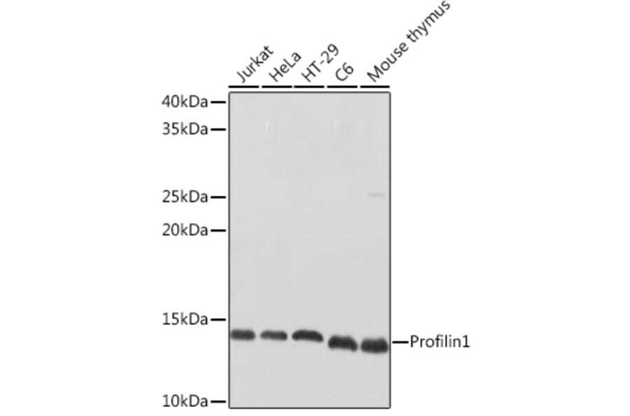 Western Blot - Anti-Profilin 1 Antibody (A13340) - Antibodies.com