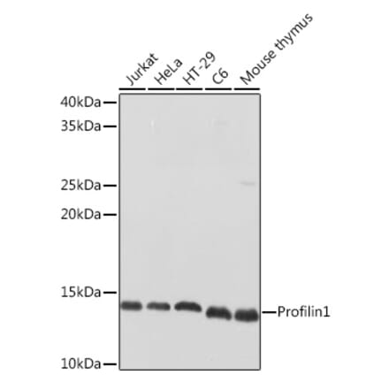 Western Blot - Anti-Profilin 1 Antibody (A13340) - Antibodies.com