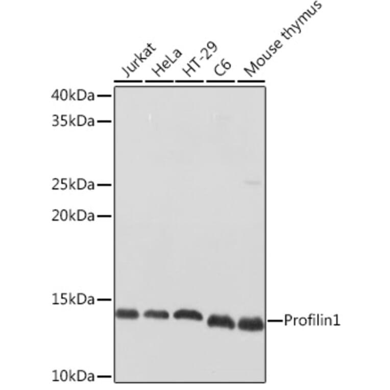 Western Blot - Anti-Profilin 1 Antibody (A13340) - Antibodies.com