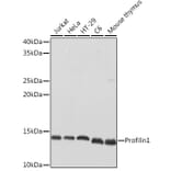 Western Blot - Anti-Profilin 1 Antibody (A13340) - Antibodies.com