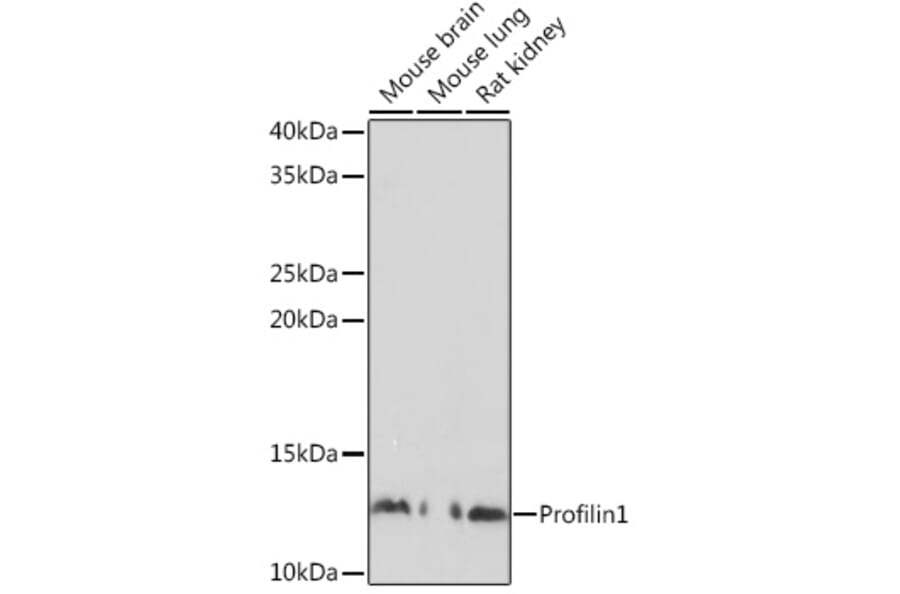 Western Blot - Anti-Profilin 1 Antibody (A13340) - Antibodies.com