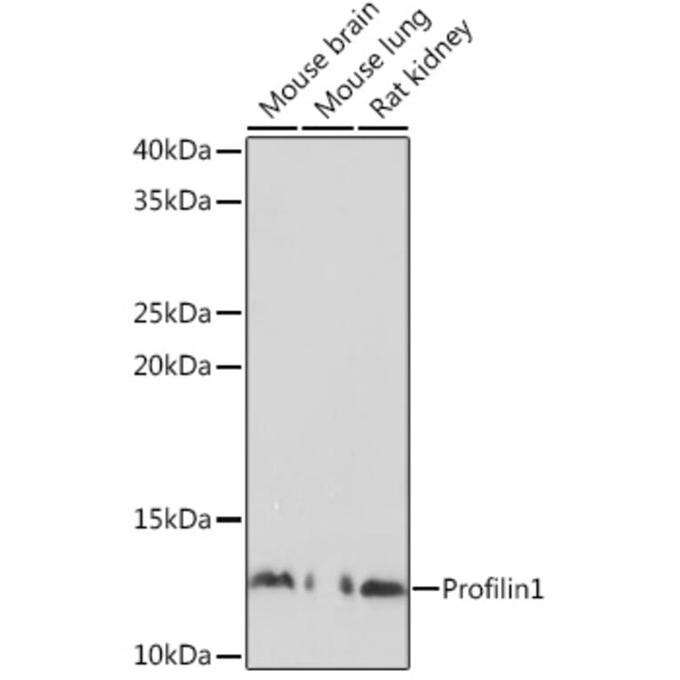 Western Blot - Anti-Profilin 1 Antibody (A13340) - Antibodies.com