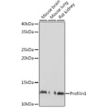 Western Blot - Anti-Profilin 1 Antibody (A13340) - Antibodies.com