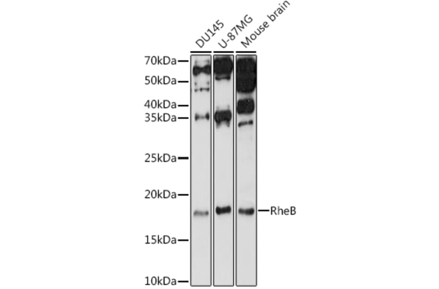 Western Blot - Anti-RHEB Antibody (A13341) - Antibodies.com