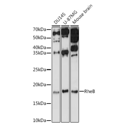 Western Blot - Anti-RHEB Antibody (A13341) - Antibodies.com