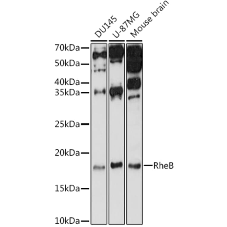 Western Blot - Anti-RHEB Antibody (A13341) - Antibodies.com