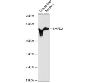 Western Blot - Anti-nSMase Antibody (A13342) - Antibodies.com