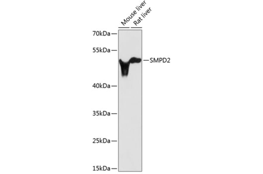 Western Blot - Anti-nSMase Antibody (A13342) - Antibodies.com