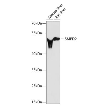 Western Blot - Anti-nSMase Antibody (A13342) - Antibodies.com