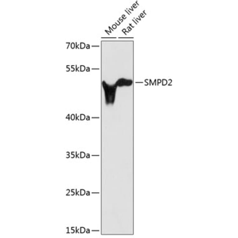 Western Blot - Anti-nSMase Antibody (A13342) - Antibodies.com