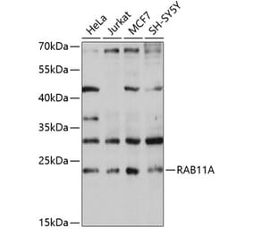 Western Blot - Anti-Rab11A Antibody (A13343) - Antibodies.com