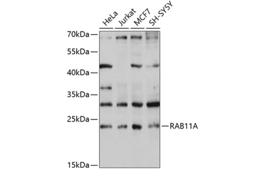 Western Blot - Anti-Rab11A Antibody (A13343) - Antibodies.com