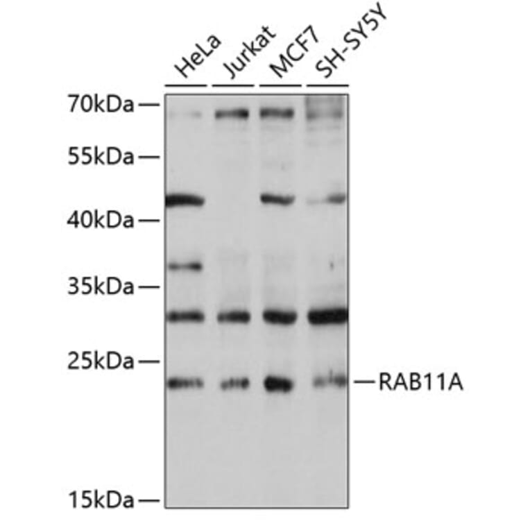 Western Blot - Anti-Rab11A Antibody (A13343) - Antibodies.com