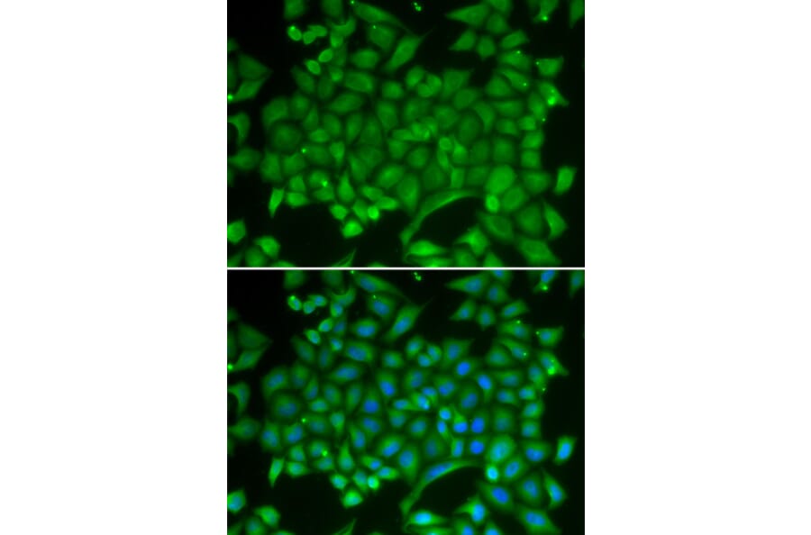 Immunofluorescence - Anti-Rab11A Antibody (A13343) - Antibodies.com