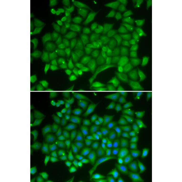 Immunofluorescence - Anti-Rab11A Antibody (A13343) - Antibodies.com